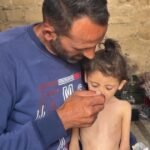 6-year-old-girl-in-Gaza-weighs-just-13-pounds-amid-growing.j.jpeg