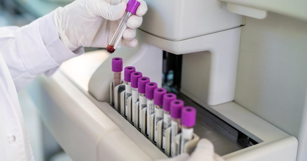 FDA-greenlights-marketing-of-first-Alzheimers-blood-test-for-some.jpg
