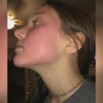 Yes-To-recalls-sheet-mask-after-skin-reactions.jpg