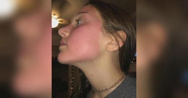 Yes-To-recalls-sheet-mask-after-skin-reactions.jpg