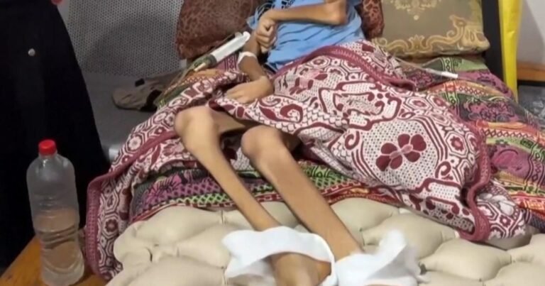Disturbing-images-of-starvation-in-Gaza.jpg