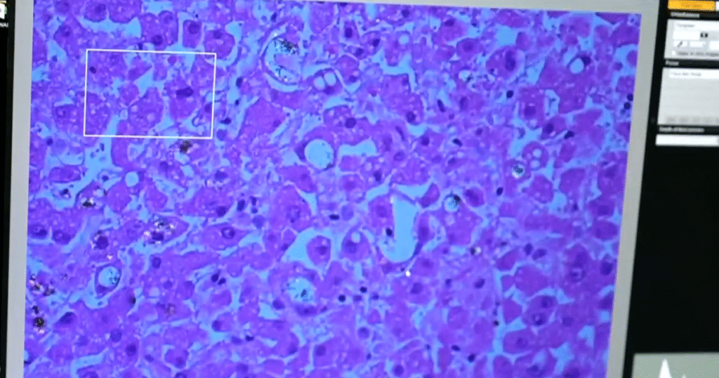 How-nanoplastics-may-be-impacting-our-long-term-health.png