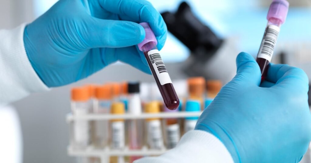 Hepatitis-C-is-a-silent-epidemic-in-the-US-but.jpg
