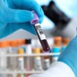 Hepatitis-C-is-a-silent-epidemic-in-the-US-but.jpg