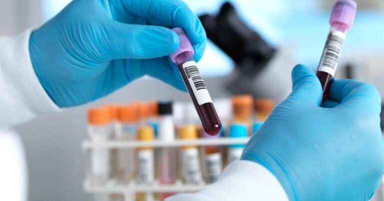 Hepatitis-C-is-a-silent-epidemic-in-the-US-but.jpg